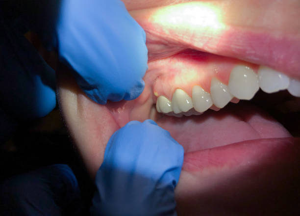 Best Emergency Dental Services for Seniors in Cornersville, TN