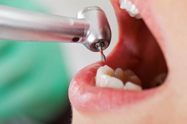 Best Mobile Emergency Dentist in Cornersville, TN